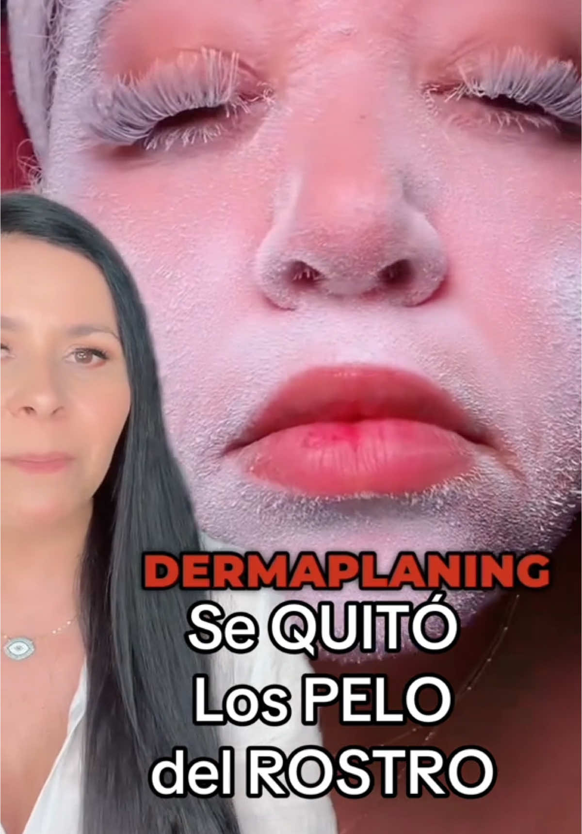 Se QUITO los PELOS del Rostro!! ✨