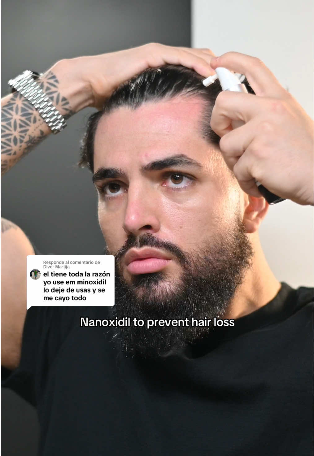 Respuesta a @Diver Martija una de las ventajas del nanoxidil es que sus resultados son permanentes y no tienen ese efecto rebote o perdida del cabello que genera minoxidil cuando dejan de utilizarlo . • siempre recomiendo ser constante al menos dos meses para conseguir los mejores resultados. • tiene un aroma bastante agradable y suelo usarlo antes de irme a dormir . #hairloss #haircare #haircareroutine #HairCareTips #alopecia #hairlossremedy #hairlosssolutions 