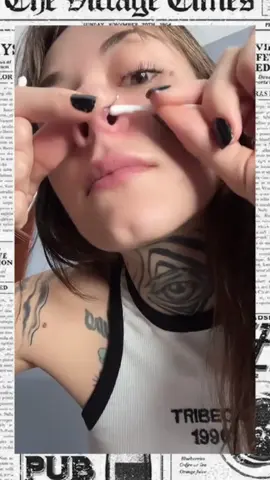 #pimpleremover #pimples #espinhas #fyyyyyyyyyyyyyyyy #ty #ty #espinhas #pimpleremover 