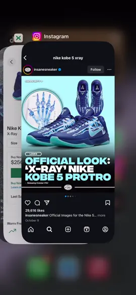 kobe 5 xray 🩻 😌 #fyp #kobes #xrays #basketball 