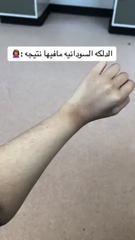 تبيض فوري بس ١٠دك فقط عرض مؤقت بنات #foryou #دلكه_سودانيه #دلكه_اصلية #دلكه_تبييض #تبيض_الجسم #تبيض_فوري #تبيض_اليدين_والرجلين #تبيض_المفاصل #تبيض_البشرة_من_اول_استعمال #الكويت #الكويت🇰🇼 #صالون 