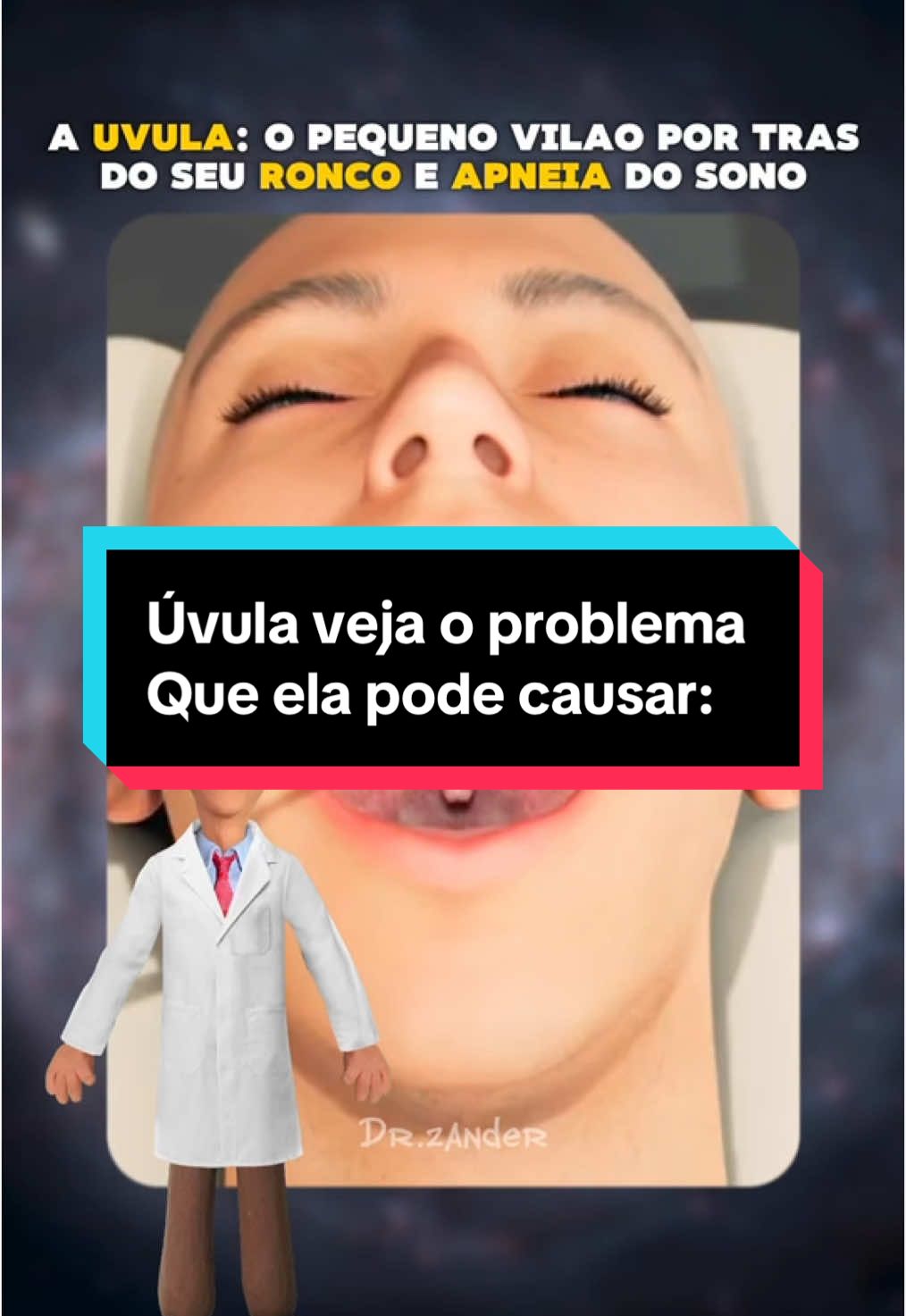 Úvula veja o problema que ela pode causar:#uvula #CuriosidadesDoCorpo #SaúdeEConhecimento #FatosSurpreendentes #MundoDaAnatomia #DescubraMais #VocêSabia? #fatoscuriosos #curiosidades #dr 