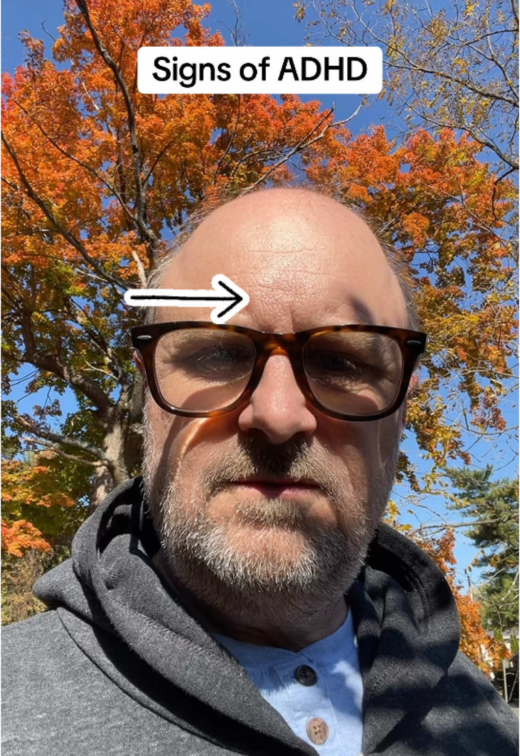ADHD can subtly shape a person’s face over time through expression lines formed by chronic restlessness, stress, and heightened emotional responses. Frequent frowning, furrowing brows in concentration, or anxious expressions from impulsivity and frustration can etch lines that reflect the inner turbulence of living with ADHD. These facial patterns may mirror the intense focus, worry, or energy that ADHD brings, becoming part of a person’s outward appearance. Yikes! #adhd #adhdtiktok #MentalHealth #MentalHealth #audhd 