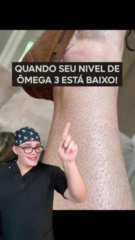 Notou algum desses sinais? 👀 ‼️ Isso pode ser um sinal de que o Ômega 3 está em falta no seu organismo. Esse ácido graxo ajuda a manter a hidratação, reduzir a inflamação e melhorar a função de barreira da epiderme. Quando ele está em baixa, a pele pode ficar mais seca, irritada e suscetível a problemas como descamação e vermelhidão. Você pode aumentar o consumo de alimentos como peixes de água fria, sementes de linhaça, chia e nozes, que são fontes ricas desse nutriente. Para quem não consome essas opções com frequência, os suplementos de Ômega 3 também podem ser uma alternativa. Já percebeu algum desses sinais na sua pele?  #skincare #cuidadoscomapele #omega3 #pelebonita #cuidadopessoal #beleza #dermatologia #saúde