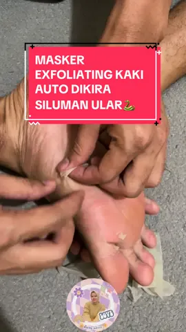 Membalas @Dita30 GAK SAKIT SAMA SEKALI YA GUYS😋 TAPI SATISFY BANGET PAS NGELOPEKINNYA💃🏻 #asmr #satisfy #satisfying 