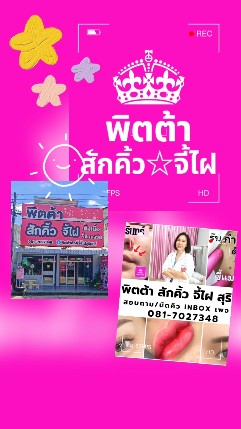 📍แจกพิกัด ร้านกำจัดไฝในสุรินทร์ 