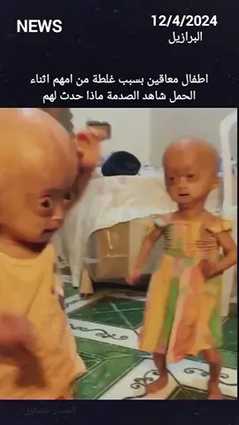 مرضهم نادر ولكنهم خفت الدم جميل