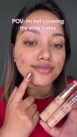 I always end up covering my acne 😅  & I trust only - Future makeup concealer💕  Using shade Porcelain Beige Future makeup Double Duty Concealer is a product designed to hide imperfections on the skin, including blemishes, dark circles, redness, and other discolorations. It typically comes in various forms, including liquid, cream, stick, or powder, and is available in a range of shades to match different skin tones. Concealers are an essential part of a makeup routine, helping to create a flawless complexion and provide a smooth canvas for other makeup products like foundation and blush. Shop at Alley Nepal 🙂 #alleynepal #alleycosmetics   #alleystore #futuremakeup #waterproofmakeup #sweatproofmakeup #futuremakeupproducts #nepalistore #makeup #makeuptutorial #makeupnepal #makeupartistnepal 