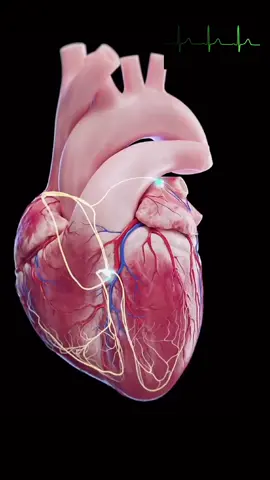 💓 El sistema de conducción cardíaco es clave para que tu corazón funcione correctamente. Comienza en el nodo sinusal, el marcapasos natural del corazón, y a través de impulsos eléctricos coordina los latidos, asegurando que la sangre fluya de manera eficiente por todo el cuerpo. 🌍 Si este proceso se ve afectado, pueden surgir arritmias y otros problemas cardíacos. Mantén tu corazón sano y funcionando a ritmo perfecto. 🫀 #Cardiología #SaludDelCorazón #Medicina #SistemaDeConducción #Arritmias #CorazónSano #medikalmuneris #anatomia  #corazon #SaludCardiaca #Bienestar #CuidadoDelCorazón
