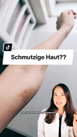 Wusstest Du davon? 🤔 ➡️ FOLGE UNS für mehr Wissen von A-Z rund um unser größtes Organ und BESUCHE UNS in unserer Online-Hautarztpraxis per App (erhältlich für Android & iOS📲🩷 #pigmentflecken #hautflecken 