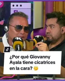 Giovanny Ayala se sinceró en El Klub y reveló si realmente es bravo, cómo algunos dicen, además contó por qué tiene cicatrices en la cara y cuántas cirugías se ha realizado. #LaKalle #giovannyayala #Cirugías #chismestiktok