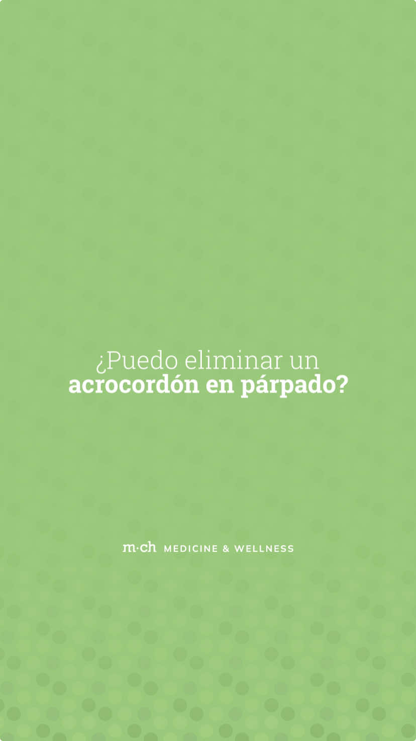 Elimina esos molestos acrocordones en los párpados con Láser CO2! Lo mejor es este procedimiento no solo se limita a la zona de parpados, podemos tratar diferentes zonas del rostro o cuello, por ejemplo.  Si tienes pequeñas protuberancias en los párpados que te incomodan, ¡este procedimiento podría ser para ti! Comenta aquí para saber más 💚 #acrocordones #laserCO2 #dermatologia #medicinaestetica