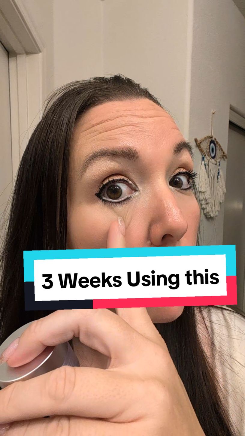 Best cream I have used for eye 👀 bags. 3 weeks of using this #Gopure eye repair cream! ##GopureSuperBrandDay #GopureSuperBrandDay #eyecream #bagsundermyeyes #skin #skincare #brighterskin #wrinkles #crowsfeet #tiktokshop #resultsmayvary 