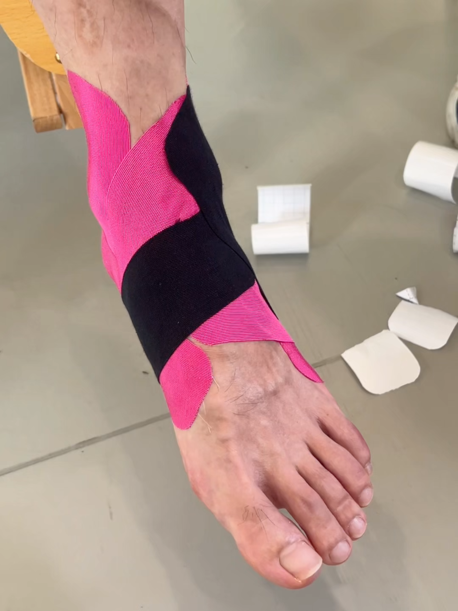 Does kinesiology tape work for plantar fasciitis? Since plantar fasciitis usually develops from excessive strain, kinesiology taping can reduce the stress on the plantar fascia and hold it in place. #foryou #kinesiologytape #muscle #foot #plantarfasciitis #pain