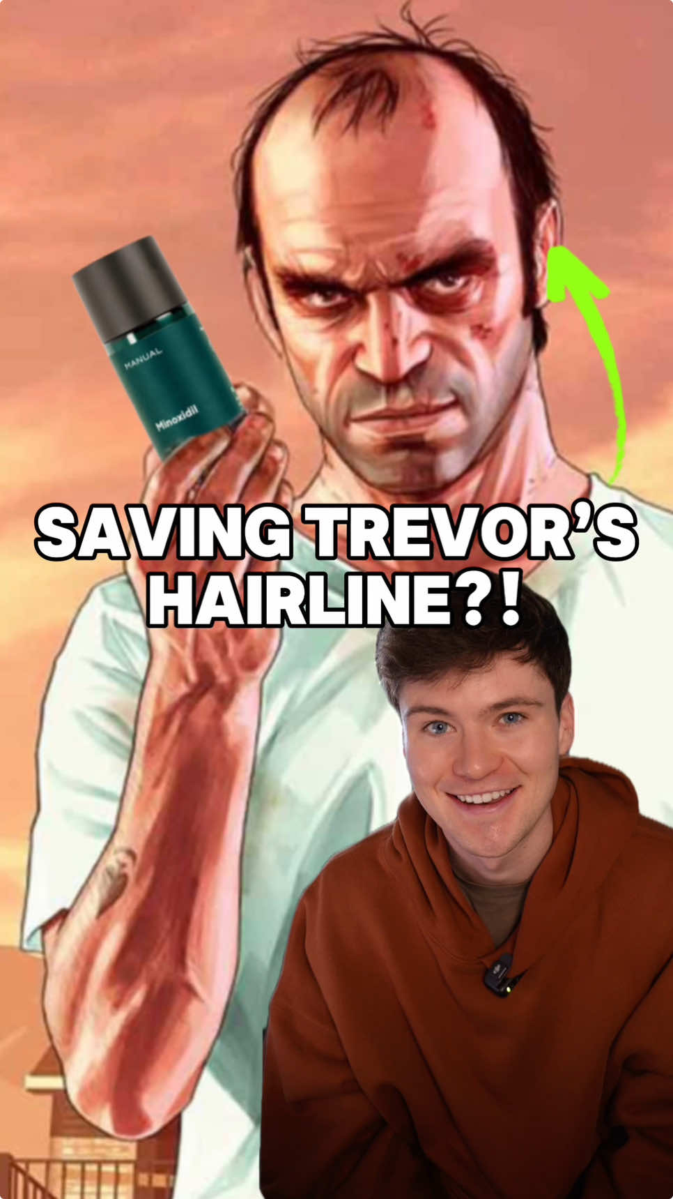 We got Trevor’s hair loss protcol before gta 6 😭 Follow to save your hair! #hairlosssolutions #gta5 #gta6 #menshair #thinninghair 