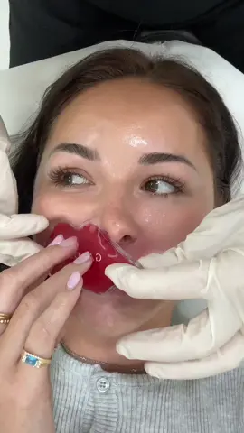 removing my filler 😳