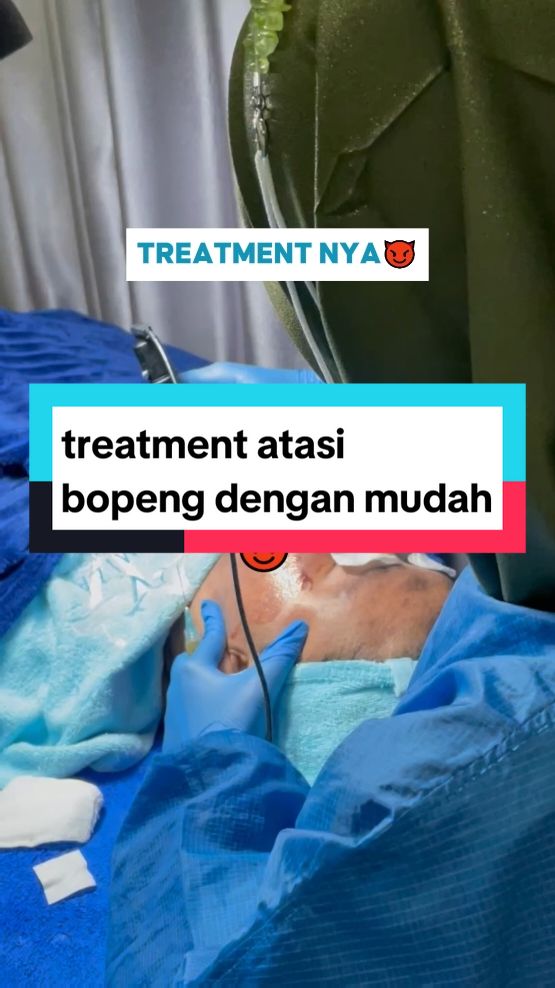 bopeng teratasi pakai treatment ini ✨#amizanaturalskincare #kabarkendal #treatment #boppeng #scar #fyp #viral 