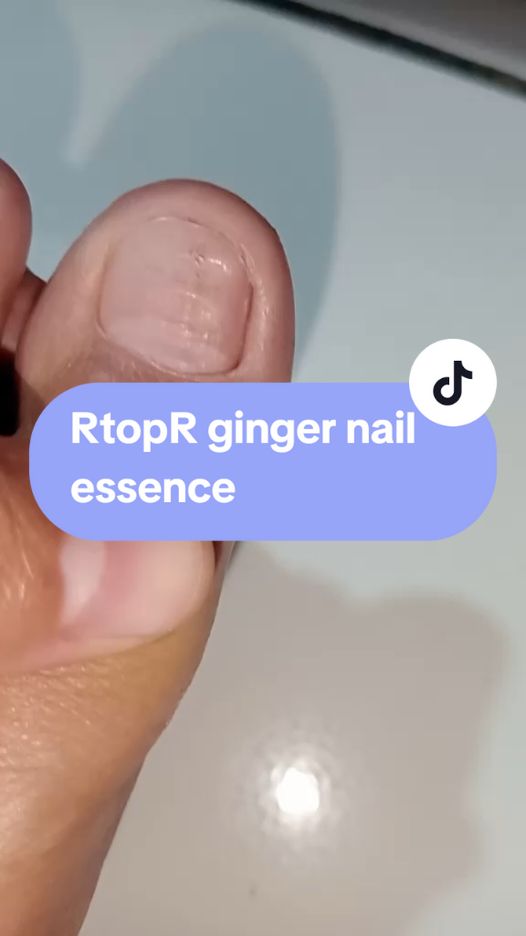 RtopR ginger nail essence #rtoprgingernailessence #rtoprnailessence #vitaminkuku #jamurkuku #wibgajian