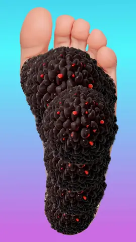 ASMR Foot Treatment - #asmr #animation #satisfying #viralvideo #asmr #asmranimation #asmrremove #asmrvideo