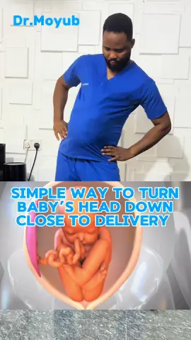 Simple way to bring baby’s head down. #pregnancy #fyp 
