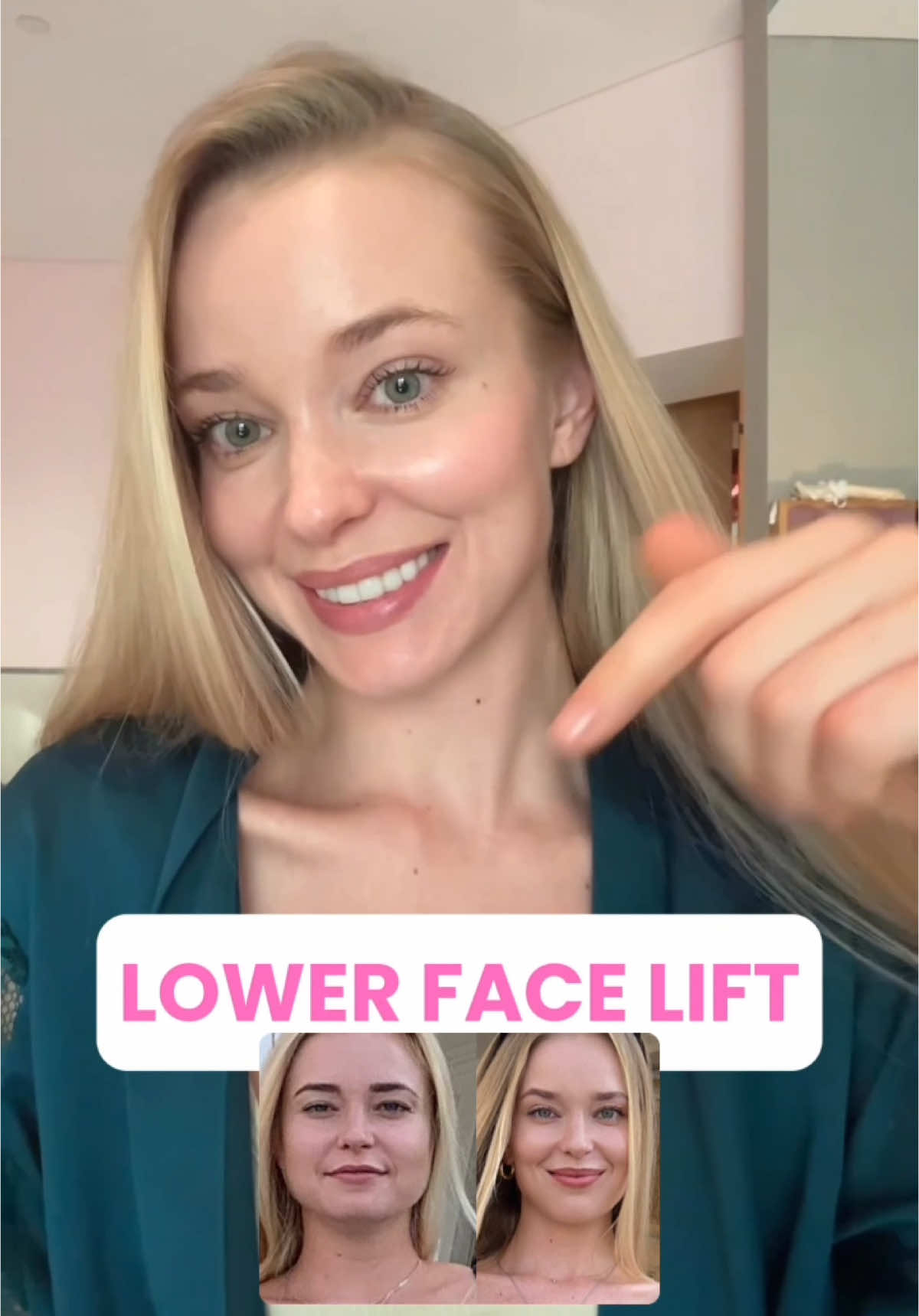 In order to achieve a Lower Face Lift, you need to work on the areas that are pulling it down. And yes, it starts with the chest. Remember that your platysma is connected from your chest and anterior deltoid up to your cheeks. So, of course, with the wrong posture, or just with the way we carry ourselves on a regular basis, or with the adhesions that come with age, the pull is coming from your chest and pulling on your jaw. That not only leads to an undefined neck but also to saggy cheeks. Want a full step-by-step plan to help you transform your face this November? Enrollment to my 30-Day Face Transformation Program is closing very soon (literally the last spots) so make sure you don't miss out! #necklift#facelift#cheeklift#selfmassage