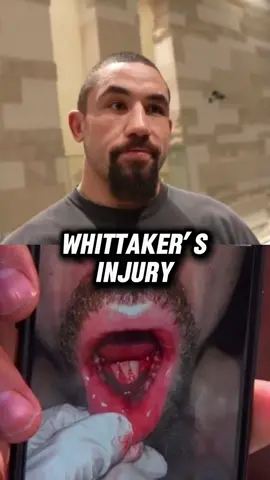 Robert Whittaker discusses the injury he suffered in his loss to Khamzat Chimaev at UFC 308. He seems to be ok thankfully. What a move by Chimaev though…🤯  🎥 @redcornermma  #UFC #robertwhittaker #khamzatchimaev #ufc308 #fyp 