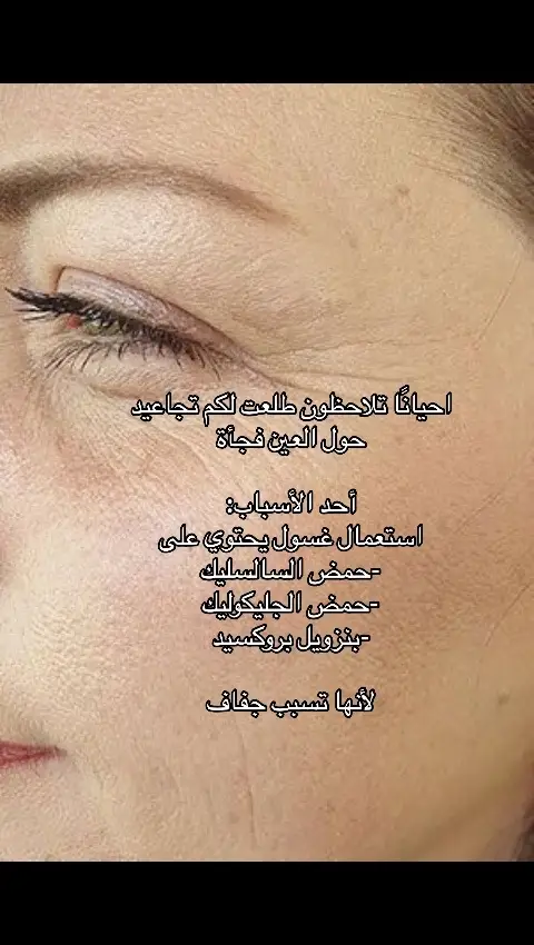 #تجاعيد #تجاعيد_تحت_العيون #تجاعيد_العين #skincare #العناية_بالشعر