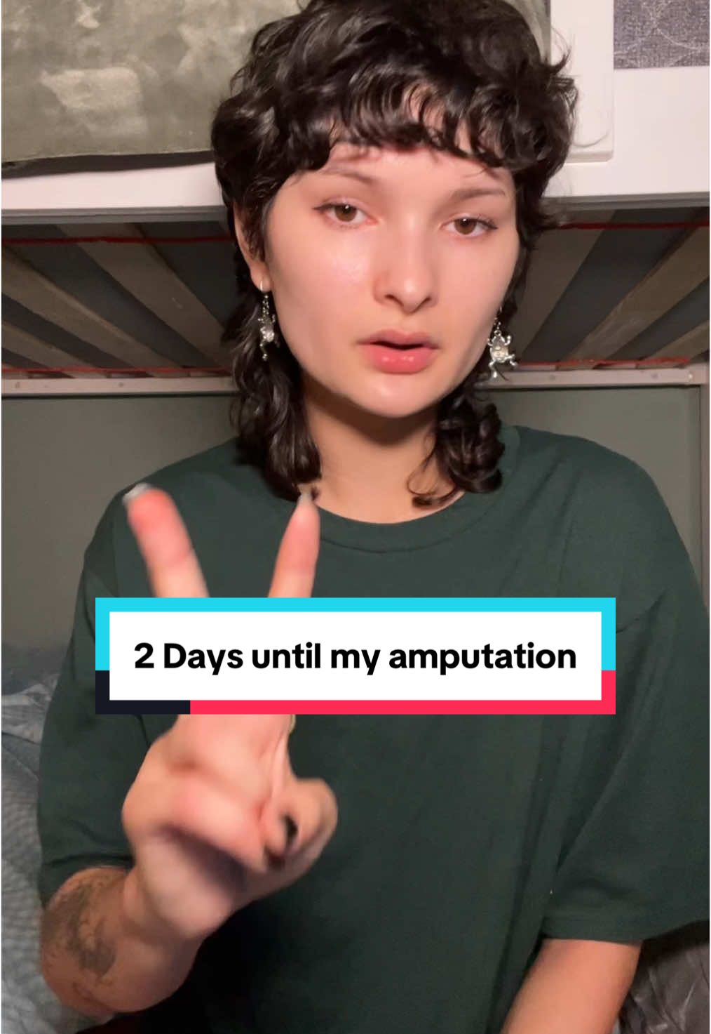 Gofundme link in bio if you’d like to donate or read my story (,: prosthetics are expensivvvee #cancer #cancersucks #sarcoma #amputee #amputeetiktok #cancerfighter #chemo #chemotherapy #synovialsarcoma 