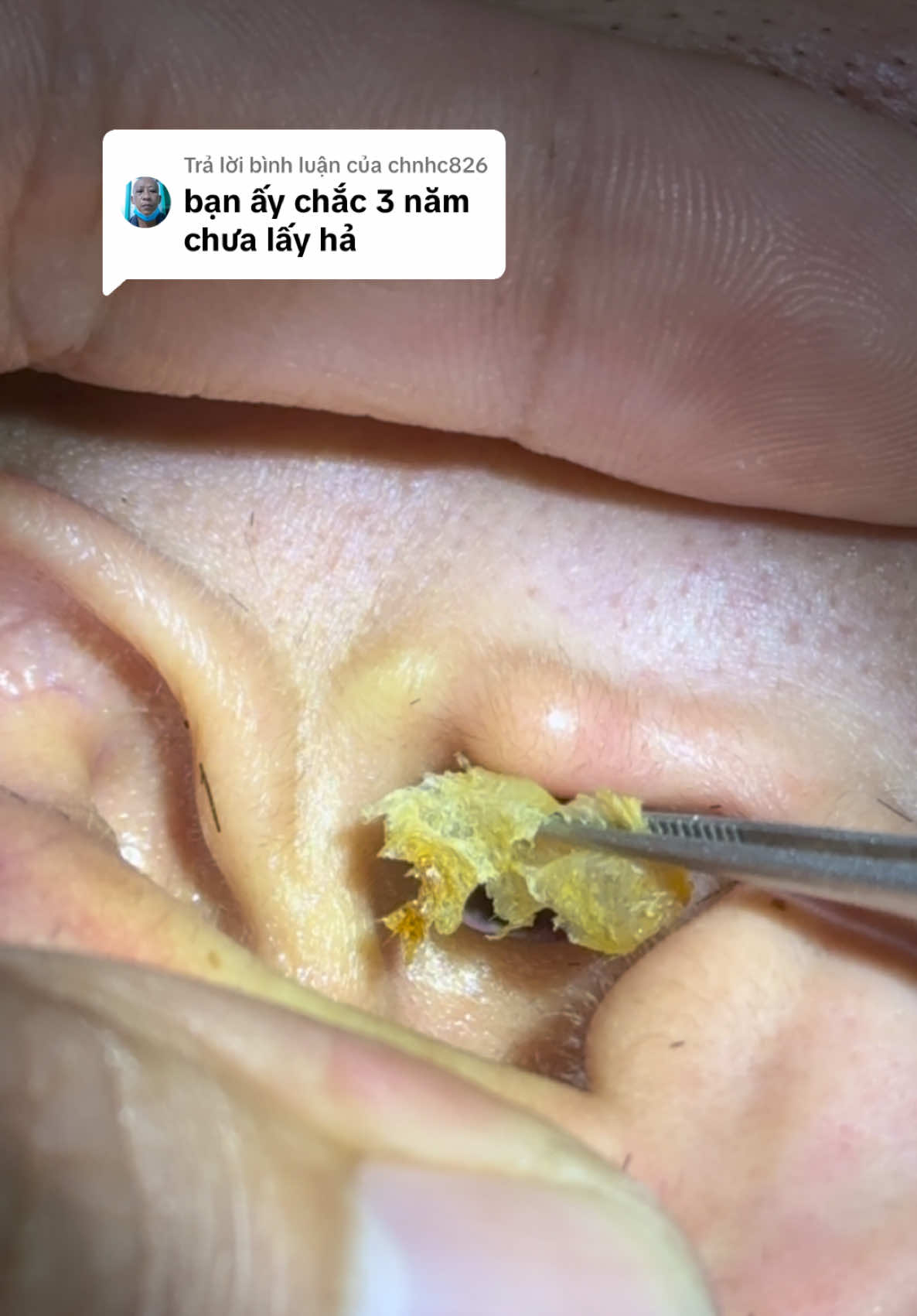 Trả lời @chnhc826 ráy tai siêu khủng #xuhuong #raytaisieukhung #htbarbershop 
