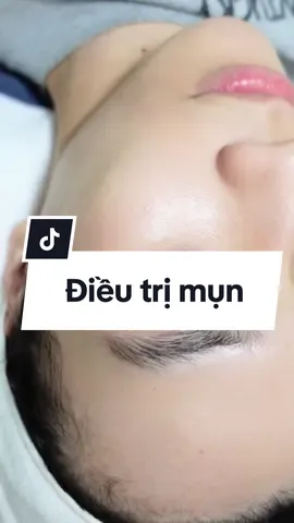 Cam thường ai nói dùng app hay chỉnh video là giận liền 🥹. Công sức mài giũa miệt mài của tui, ai gặp đều biết da ở ngoài đẹp hơn nhiều nhé. Mịn tưng như em bé cơ, ko có 1 tý lcl nào. Video vẫn rõ mụn ở trán nhen. #trimun #spatayho 