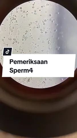 sperma under microscope... video by @f4dill4h_28  #dokter #rumahsakit #labkesda #pemeriksaansperma #medicallaboratorytechnician #medicallaboratory #atlm #analiskesehatan👩‍🔬🔬 #mahasiswakesehatan #perawatindonesia #mahasiwakesehatan 