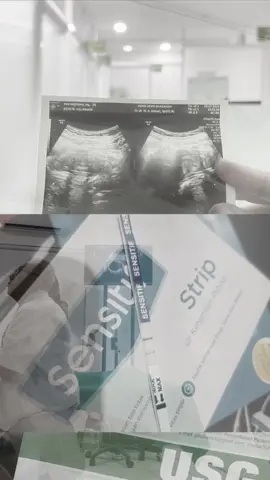 Sal, matahariku sudah pergi ke Surga🥹  Maaf yaa dek ibu masih sering nangis. Bahagia di Surga cintanya ibu👼🏻🩶  #CapCut #fyppppppppppppppppppppppp #fypviralシ #keguguran #anaksurgaku #pregnant #trimester1 #matahariku 