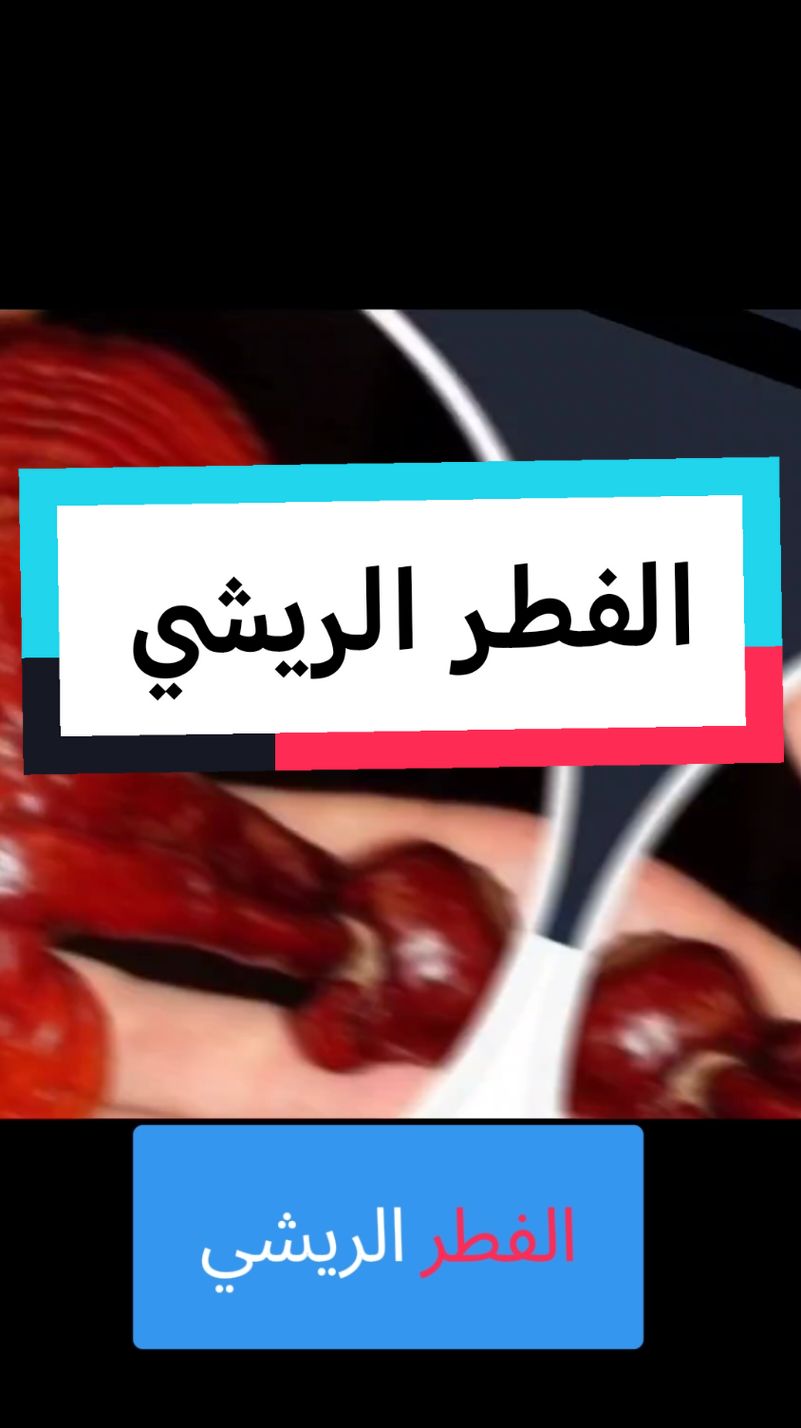 الفطر الريشي يعتبر الفطر الريشي جانوديرما من أقدم أنواع الفطر الريشي في العالم #الفطرالريشي #reishi #rimehdxn #integratori #naturale #alimentari 