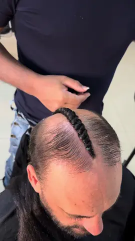 ##trancasdoreicareca #trancacareca #trançaenraizada #trançacalvo #tranças #trançacareca #trancasenraizadas #hairstyle #careca #trança #tranças #trançasboxbraids #trançasnago #afro #afrobeats #afrohair #afrohair #afropop @eusouajanaina 