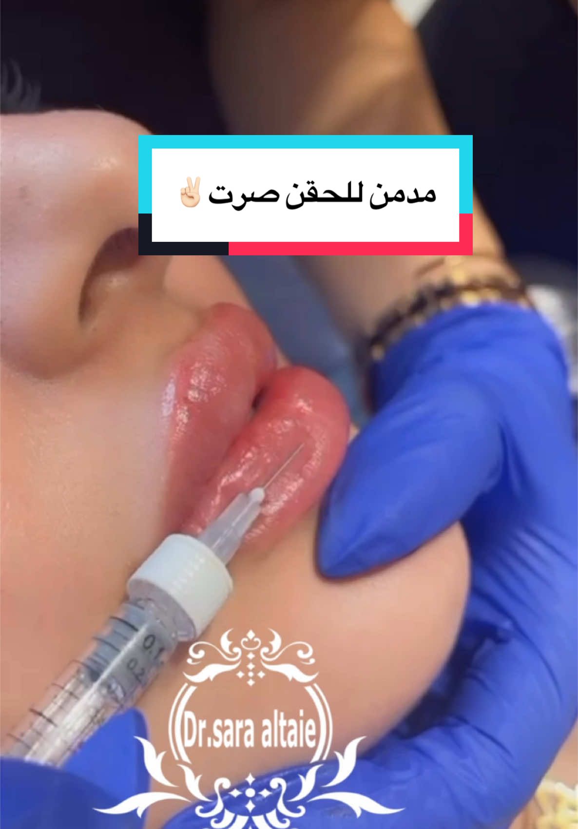 #tiktok #trending #تجميل #lips #جمال 