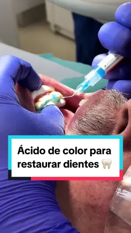 A los niños se les dice que sabe a limón, pero es variable 👀 #odontologia #dentist 
