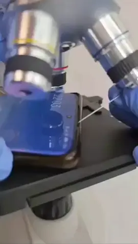 Not for the faint of heart Twitter showed us what our phones look like under a microscope. In the holes are very many bedbugs and parasites.  