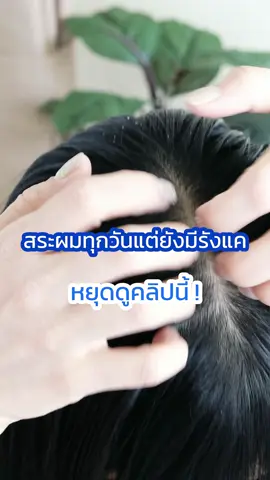 สระผมทุกวันแต่ยังมีรังแค หยุดดูคลิปนี้ #ปกป้องดูแลฟีลแฟน48ชั่วโมง #HeadandShouldersTH #Ad #รังแค #แชมพูขจัดรังแค #ขจัดรังแค