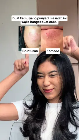 COSRX AHA BHA Exfoliating Toner emang paling serba bisa untuk kulit komedo dan bruntusan 😍 Checkout sekarang yuk, #TemanCOSRX! #COSRX #COSRXIndonesia #koreanskincare #skincareviral #exfoliatingtoner #komedo #bruntusan