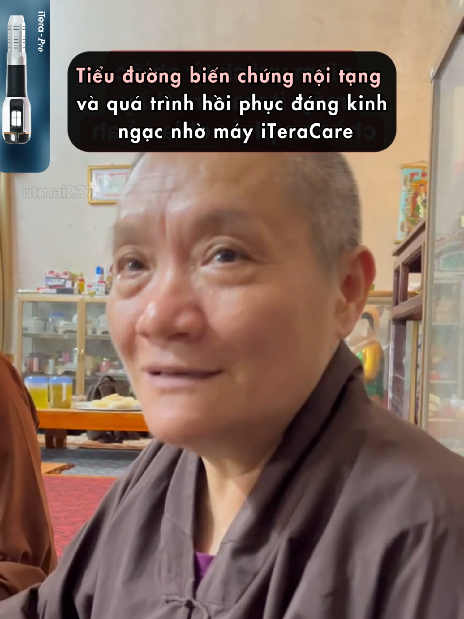 Biến chứng tiểu đường và quá trình phục hồi đáng kinh ngạc nhờ máy iteracare #utmaiprife #trilieu #terahertz #bienchungtieuduong
