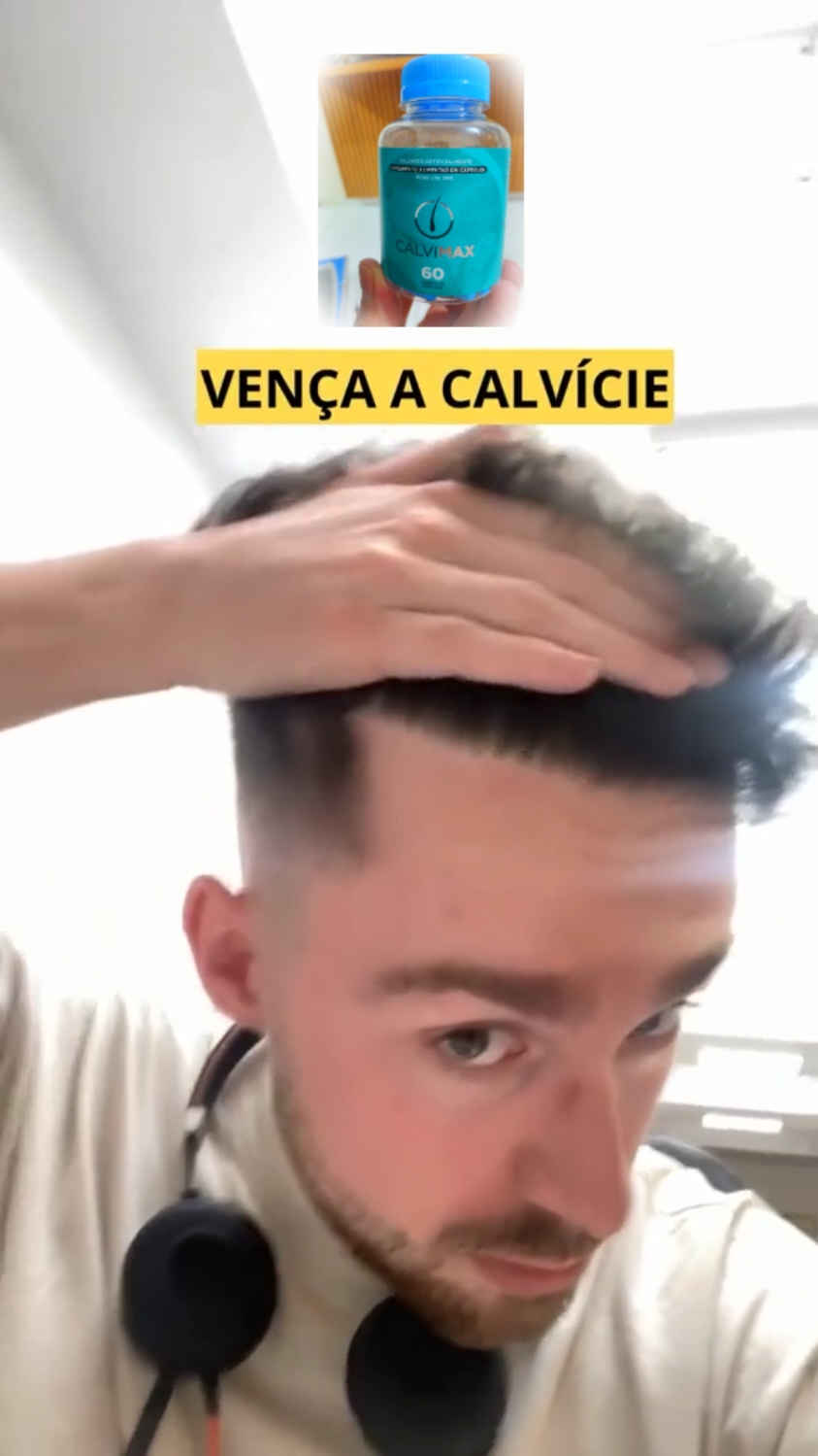 Calvimax o Tratamento Premiado para Reversão da Calvície. Compre Através do Link na Bio #calvicie #calviciemasculina #calvo #crescimentocapilar #tratamentocalvicie #quedadecabelo 