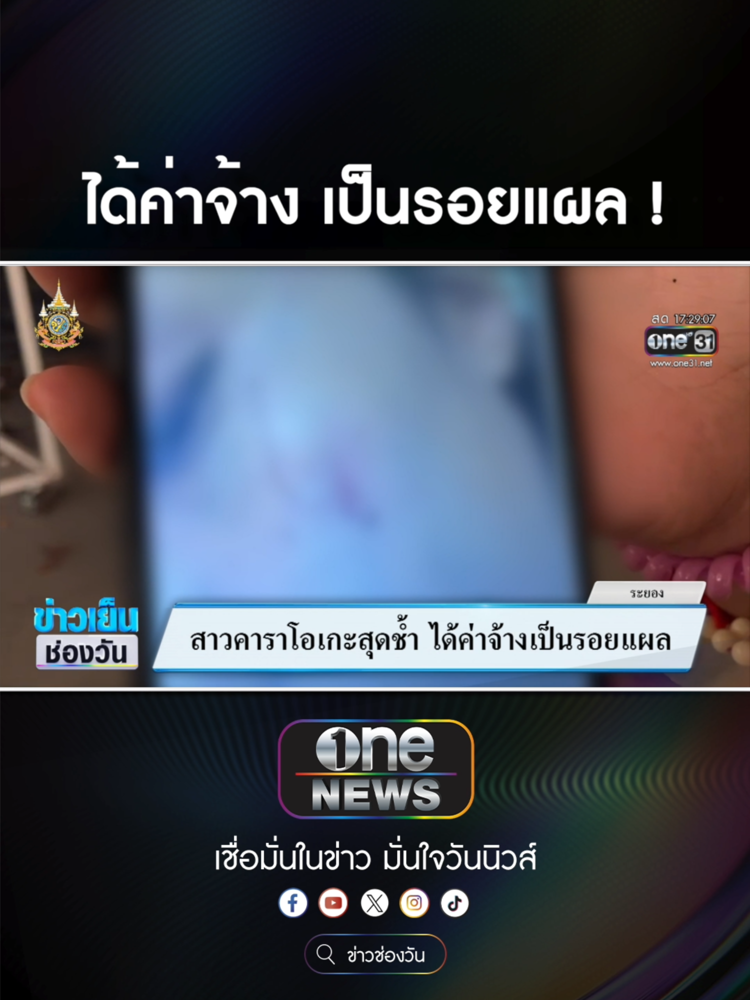 สาวคาราโอเกะสุดช้ำ ได้ค่าจ้างเป็นรอยแผล  #ข่าวช่องวัน #ข่าวtiktok #สํานักข่าววันนิวส์ #one31news  ไฮยีน หอมสดชื่นยาวนานตลอดวัน สกัดจากธรรมชาติ 100% #ไฮยีน #หอมสดชื่น #น้ำยาปรับผ้านุ่ม #งานบ้านที่รัก