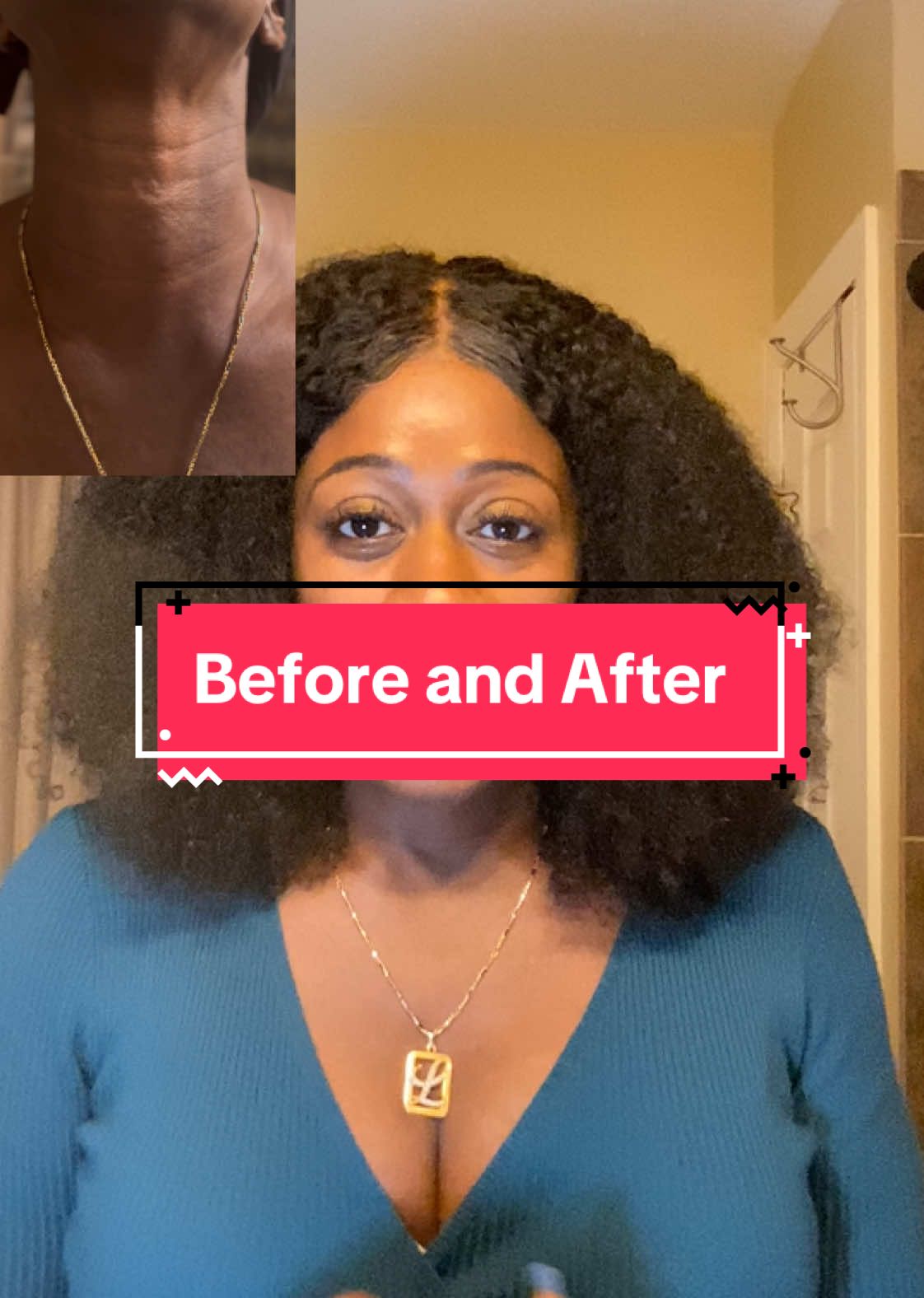 This firming neck cream works!! #BeforeAndAfter #Firming #neckcream #BestNeckFirmingCream2024 #NeckFirmingCreamThatActuallyWorks #BestFirmingCreamForSaggySkin #DryNeckFirmingCream #FirmingNeckCream #BestNeckFirmingAndTighteningCream #NeckTightening#Over40Moms #over50 #antiaging #skinroutine #nofilter 