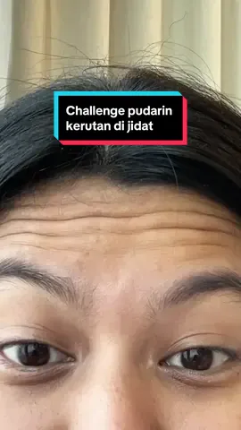 Challenge pudarin kerutan di jidat! #facemask #polynia #glassskin #skincaretips #skincarehacks #fyp #glowing #beforeandafter #skinjourney 