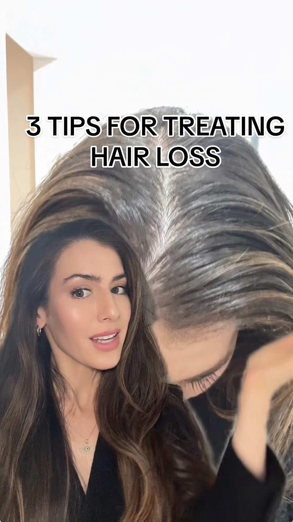 Struggling with hair loss? I get it because I’ve been there too. Here are my top 3 tips to combat hair loss and get back to feeling like your best self 😘 #hairtok #hairlossremedy #hairlosstreatment #hairlosstips #hairgrowth #supplements #vitamins #haircare #worthbuying #dermatologist #rogaine #minoxidil #nutrafol  @Rogaine @nutrafol 