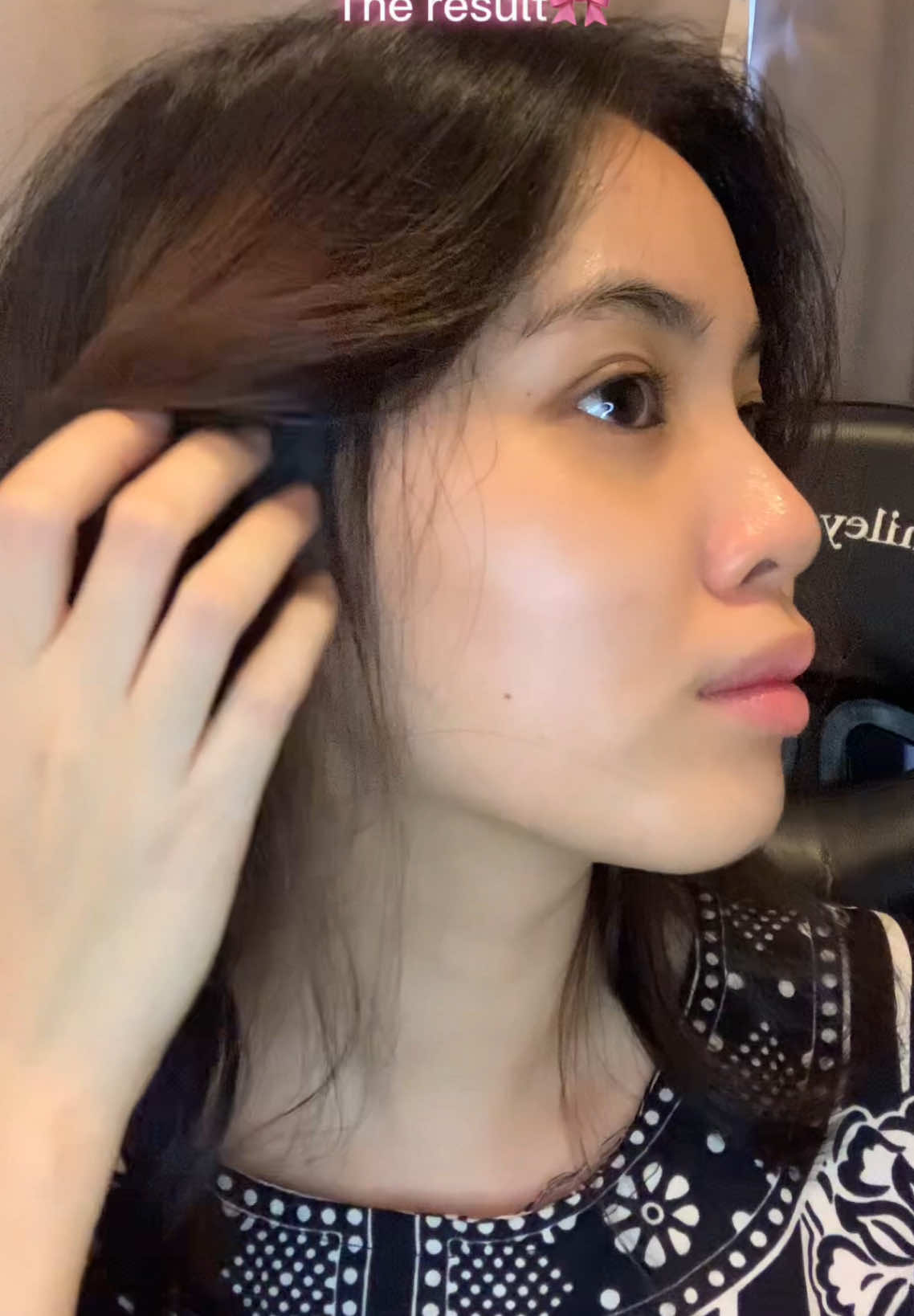 LOOK AT MY SKIN!😱 #skintificmy #skintificmalaysia #skintific #glowingskin #brighteningmoisturizer #skincare #skincareroutine #skincaretips #skincareproducts #fyp #fypシ #fypシ゚viral #foryou #fouryoupage @skintific.my 