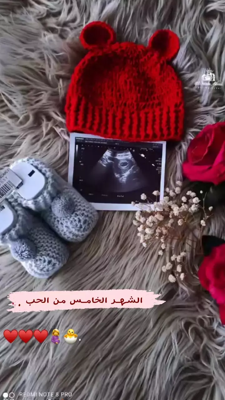 حسب الطلب الشهرالخامس ♥ #حوامل_اي_شهر_صرتو_🤰🤰😍🦋 #صبي #بنت #بيبي👼🏻💙 #هدية_من_الله_اجتني_ونورت_قلبي❤️😌 #حب #بدون_مسيقى 