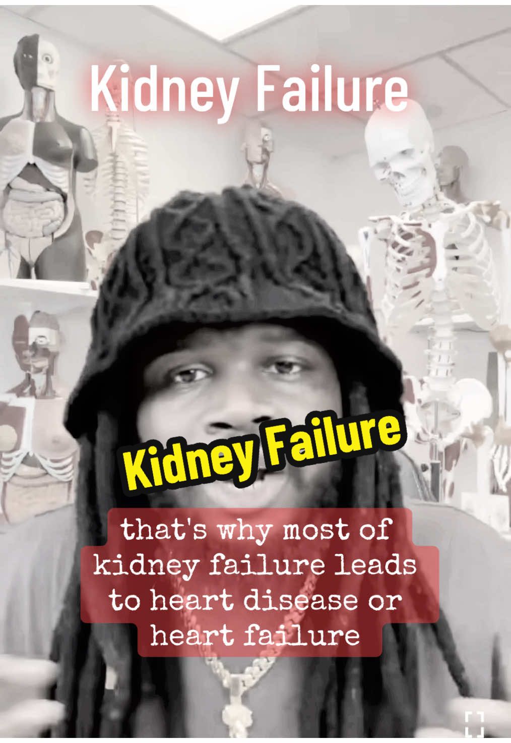 #CapCut #kidneyfailure #kidney #kidneydisease #kidneys #kidneystone #health 