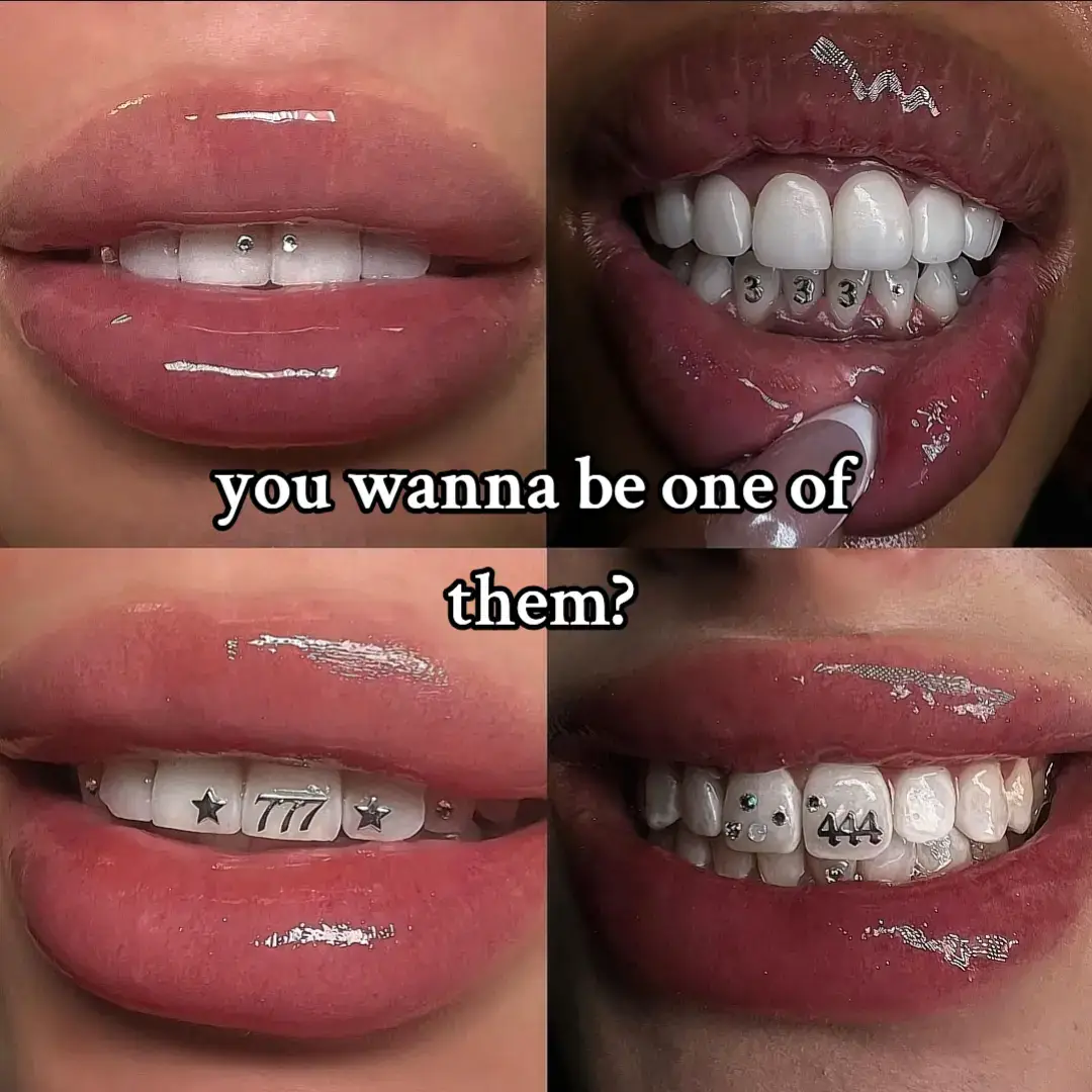 #teeth #straightteeth #foryoupage #iykyk #relatable #viral #toothgems #beauty #fyp 