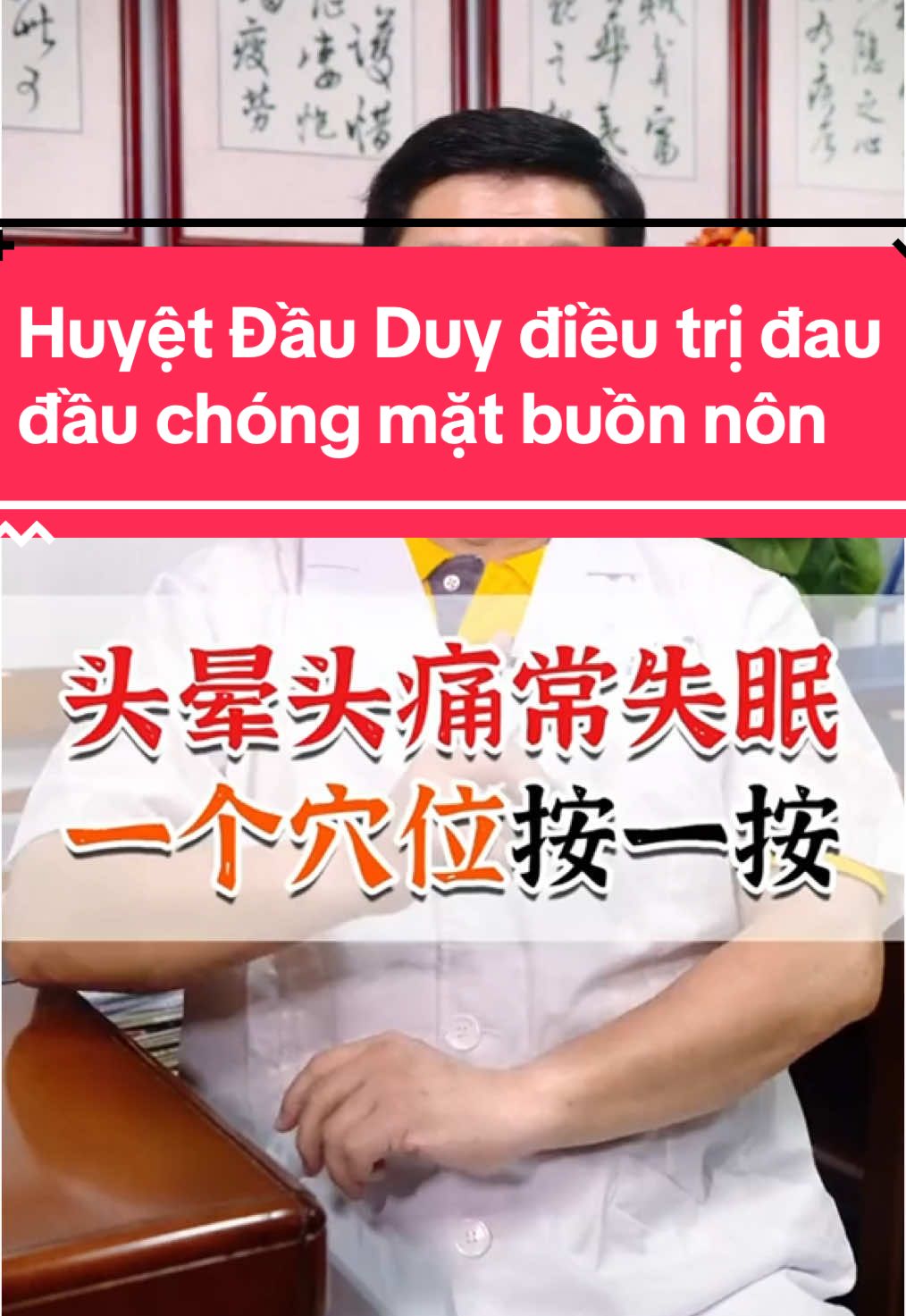 Áp dụng huyệt Đầu duy điều trị chóng mặt, buồn nôn, mất ngủ, đau đầu, tăng cường sức khỏe ! #huyetdauduy #dieutrichongmatbuonnon #daudau #matngu #tangcuongsuckhoe #bamhuyet 